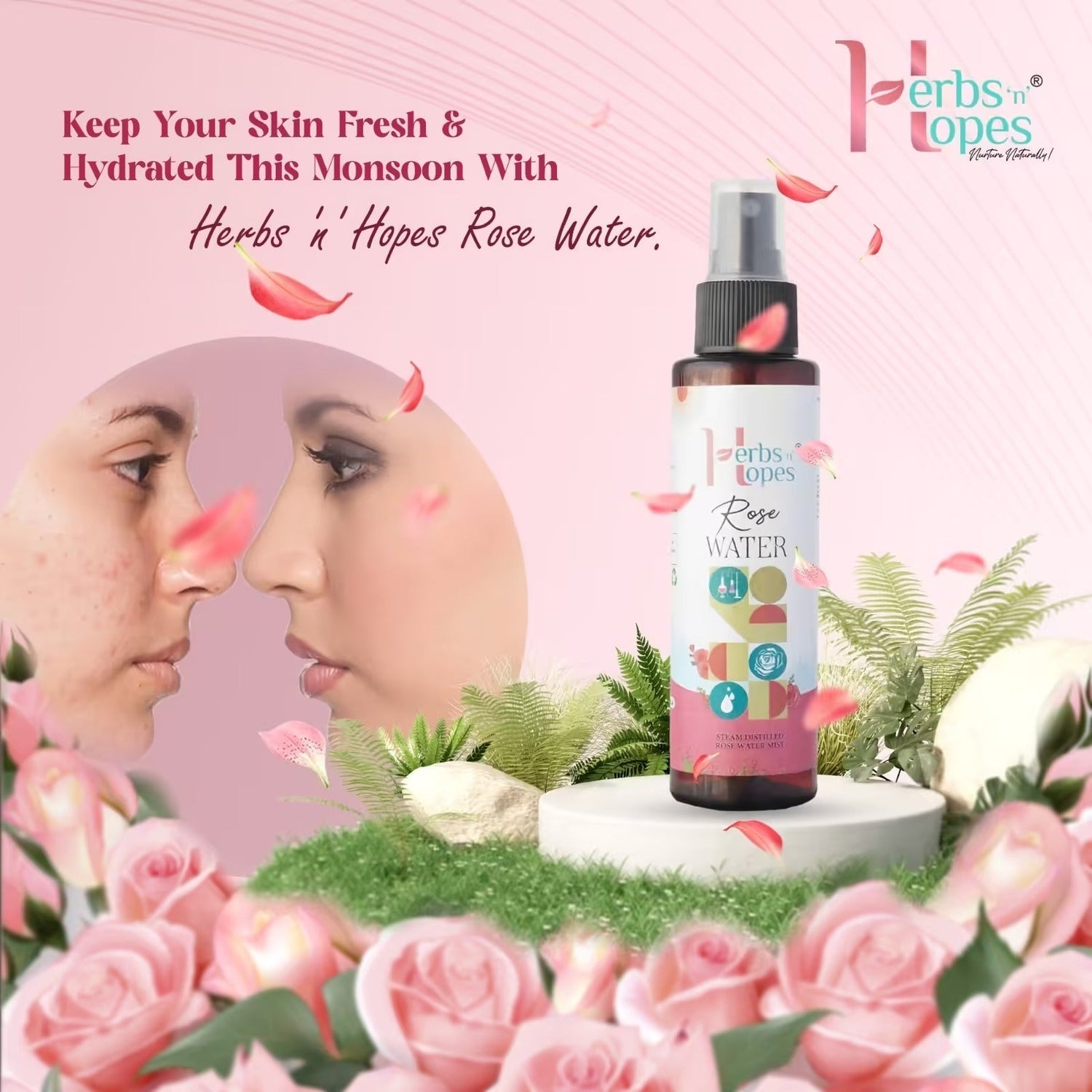 Fighting Acne Naturally: 5 Effective Tips with Herbs ‘n’ Hopes