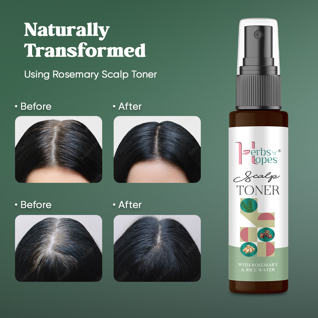 Rosemary Scalp Toner