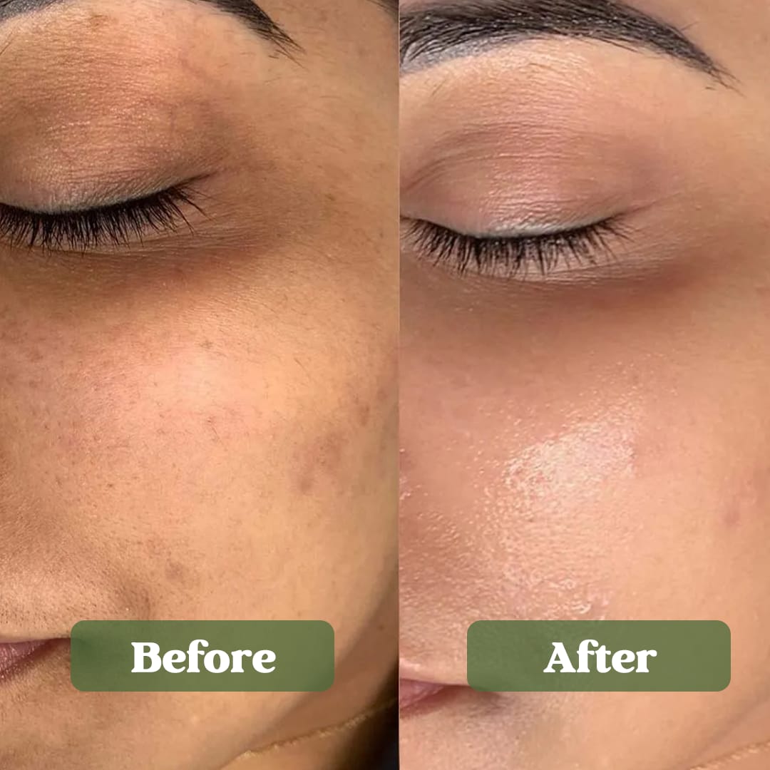 Soundaryam Face Mask