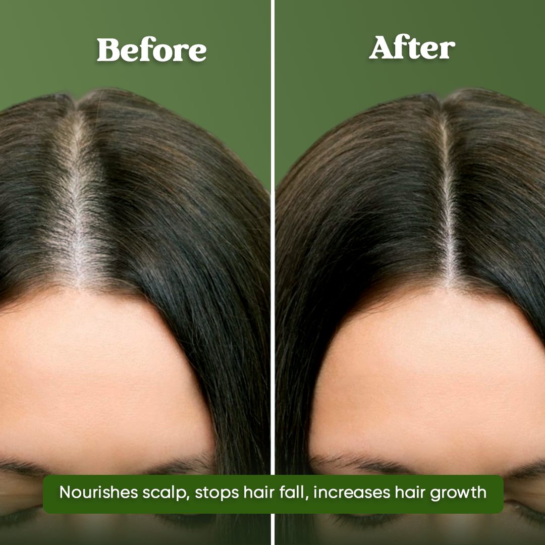 Herbal Hair Oil
